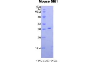 SDS-PAGE of Protein Standard from the Kit (Highly purified E.