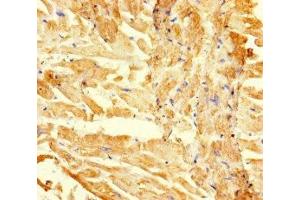 Immunohistochemistry of paraffin-embedded human heart tissue using ABIN7167709 at dilution of 1:100 (RGMA anticorps  (AA 153-408))