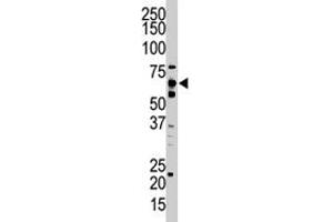 The UBQLN2 polyclonal antibody  is used in Western blot to detect UBQLN2 in HeLa cell lysate. (Ubiquilin 2 anticorps  (C-Term))