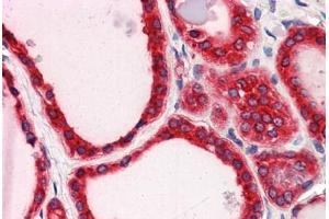 anti-Tripartite Motif Containing 33 (TRIM33) (C-Term) antibody