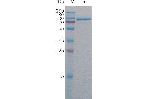 Human MELTF Protein, His Tag on SDS-PAGE under reducing condition.