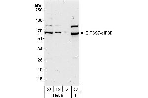 anti-Eukaryotic Translation Initiation Factor 3, Subunit D (EIF3D) (AA 200-250) antibody