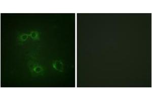 Immunofluorescence analysis of COS7 cells, using FAS (Phospho-Tyr291) Antibody. (FAS anticorps  (pTyr291))