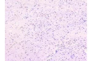 IHC analysis of TNFRSF11B using anti-TNFRSF11B antibody (ABIN7600875).