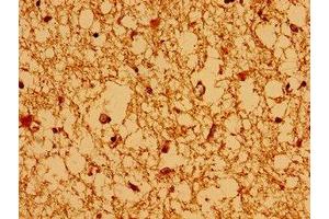 Immunohistochemistry of paraffin-embedded human brain tissue using ABIN7145127 at dilution of 1:100 (AXIN2 anticorps  (AA 11-77))