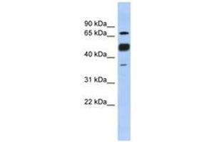 Image no. 1 for anti-Nuclear Factor of Activated T-Cells, Cytoplasmic, Calcineurin-Dependent 1 (NFATC1) (N-Term) antibody (ABIN6744415)