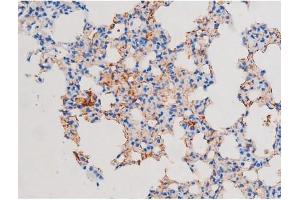 ABIN6267486 at 1/200 staining Mouse lung tissue sections by IHC-P.