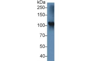 Western Blot; Sample: Rat Thyroid lysate; Primary Ab: 5µg/ml Rabbit Anti-Mouse TPO Antibody Second Ab: 0. (Thyroperoxidase anticorps  (AA 636-832))