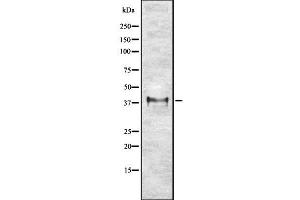 Western blot analysis of ETV2 using K562 whole cell lysates (ETV2 anticorps  (Internal Region))