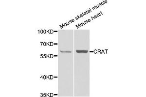 Western blot analysis of extracts of various cell lines, using Crat antibody (ABIN5973772) at 1/1000 dilution. (CRAT anticorps)