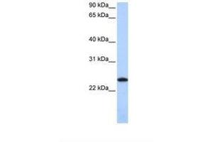 Image no. 1 for anti-Ferritin, Light Polypeptide (FTL) (C-Term) antibody (ABIN6749757)