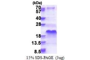 SDS-PAGE (SDS) image for Split Hand/foot Malformation (Ectrodactyly) Type 1 (SHFM1) (AA 1-70) protein (His tag) (ABIN5853387)