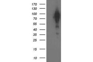 Western Blotting (WB) image for anti-Breast Cancer Anti-Estrogen Resistance 1 (BCAR1) antibody (ABIN1496833)