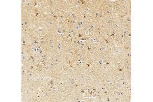 anti-Solute Carrier Family 12 (Potassium-Chloride Transporter) Member 5 (SLC12A5) (AA 228-833) antibody