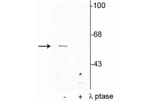 Western blot of rat cortical lysate showing specific immunolabeling of the ~62 kDa synaptotagmin phosphorylated at Thr202 in the first lane (-). (SYT1 anticorps  (pSer309))