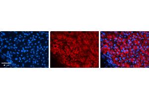 Rabbit Anti-EIF4G2 Antibody   Formalin Fixed Paraffin Embedded Tissue: Human Liver Tissue Observed Staining: Cytoplasm in hepatocytes Primary Antibody Concentration: 1:100 Other Working Concentrations: N/A Secondary Antibody: Donkey anti-Rabbit-Cy3 Secondary Antibody Concentration: 1:200 Magnification: 20X Exposure Time: 0. (EIF4G2 anticorps  (N-Term))