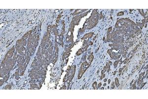 IHC analysis of GRX2/GLRX2 using anti-GRX2/GLRX2 antibody (ABIN7599022). (Glutaredoxin 2 anticorps  (AA 1-164))