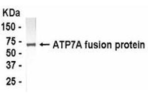 Western Blotting (WB) image for anti-ATPase, Cu++ Transporting, alpha Polypeptide (ATP7A) (AA 1407-1500) antibody (ABIN2467776)
