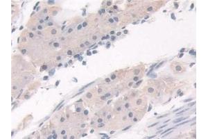 Detection of HPS4 in Human Stomach Tissue using Polyclonal Antibody to Hermansky Pudlak Syndrome Protein 4 (HPS4)