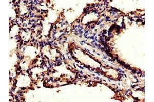 Immunohistochemistry of paraffin-embedded human lung tissue using ABIN7147080 at dilution of 1:100 (CEBPB anticorps  (AA 41-270))