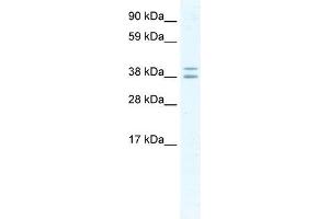 TSG101 antibody (20R-1186) used at 0. (TSG101 anticorps  (Middle Region))