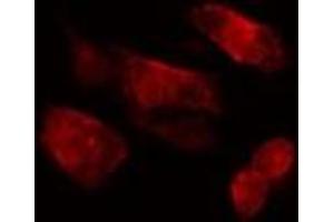 ABIN6275535 staining  HepG2 cells by IF/ICC. (PLK3 anticorps  (Internal Region))