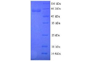 SDS-PAGE (SDS) image for Peptidoglycan Recognition Protein 2 (PGLYRP2) (AA 22-576) protein (His tag) (ABIN5714438)