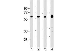 Western blot testing of Lyn antibody at 1:2000 dilution and mouse samples: Lane 1: kidney lysate; 2: heart lysate; 3: ovary lysate; 4: skeletal muscle lysate; Predicted molecular weight 56/58 kDa (isoforms 1/2). (LYN anticorps  (AA 229-263))