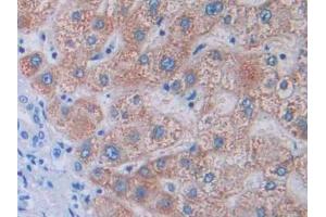 DAB staining on IHC-P; Samples: Human Liver Tissue (Tyrosine Protein Kinase 7 (AA 853-1070) anticorps)