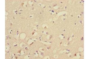 Immunohistochemistry of paraffin-embedded human brain tissue using ABIN7174506 at dilution of 1:100 (UBE2Z anticorps  (AA 115-354))