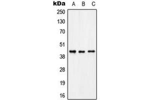 Western blot analysis of KCNAB3 expression in THP1 (A), rat brain (B), rat kidney (C) whole cell lysates.