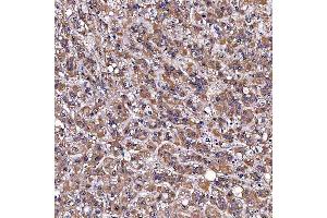 IHC analysis of TOMM34 using anti-TOMM34 antibody (ABIN7599253). (TOMM34 anticorps  (AA 1-309))