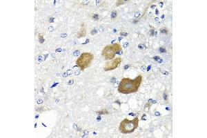 Immunohistochemistry of paraffin-embedded rat brain using IFNL1 antibody at dilution of 1:100 (40x lens). (IL29 anticorps)