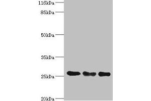 Western blot All lanes: TFAM antibody at 8 μg/mL Lane 1: Jurkat whole cell lysate Lane 2: MCF-7 whole cell lysate Lane 3: A431 whole cell lysate Secondary Goat polyclonal to rabbit IgG at 1/10000 dilution Predicted band size: 30, 26 kDa Observed band size: 26 kDa (TFAM anticorps  (AA 43-246))