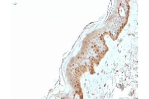 Formalin-fixed, paraffin-embedded human Skin stained with S100A2 Mouse Monoclonal Antibody (CPTC-S100A2-2).