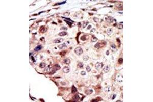 Image no. 1 for anti-RYK Receptor-Like Tyrosine Kinase (RYK) (AA 150-200) antibody (ABIN359937)