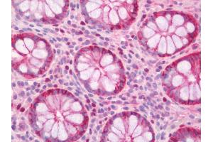 Human Colon: Formalin-Fixed, Paraffin-Embedded (FFPE)