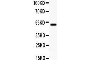 Anti- gamma Catenin Picoband antibody, Western blotting All lanes: Anti gamma Catenin at 0.