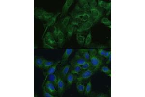 Immunofluorescence analysis of U2OS cells using FRMD6 antibody (ABIN6132194, ABIN6140773, ABIN6140774 and ABIN6225347) at dilution of 1:100. (FRMD6 anticorps  (AA 405-614))
