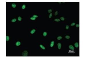 Immunostaining analysis in HeLa cells. (TCERG1 anticorps)
