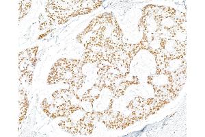 Immunohistochemistry (IHC) image for anti-gamma Histone Variant H2AX (GAMMA-H2AX) (Ser140) antibody (ABIN7455200) (Recombinant gamma H2AX anticorps  (Ser140))