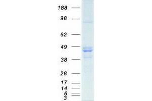 Validation with Western Blot