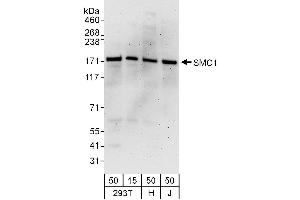 Western Blotting (WB) image for anti-Structural Maintenance of Chromosomes 1A (SMC1A) (AA 1183-1233) antibody (ABIN7454968) (SMC1A anticorps  (AA 1183-1233))