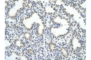 Rabbit Anti-HNRPAB antibody         Paraffin Embedded Tissue:  Human Lung    cell Cellular Data:  alveolar cell    Antibody Concentration:  4. (HNRNPAB anticorps  (C-Term))