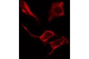 ABIN6274622 staining Hela cells by IF/ICC. (COL4a2 anticorps  (N-Term))
