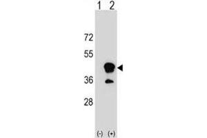 Western blot analysis of CD1b antibody and 293 cell lysate (2 ug/lane) either nontransfected (Lane 1) or transiently transfected (2) with the CD1B gene. (CD1b anticorps  (AA 57-85))