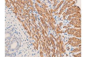 ABIN6267068 at 1/100 staining rat uterine tissue sections by IHC-P.
