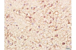 Paraformaldehyde-fixed, paraffin embedded rat brain tissue, Antigen retrieval by boiling in sodium citrate buffer(pH6) for 15min, Block endogenous peroxidase by 3% hydrogen peroxide for 30 minutes, Blocking buffer (normal goat serum) at 37°C for 20min, Antibody incubation with Rabbit Anti-PI3KCA Polyclonal Antibody, Unconjugated  at 1:400 overnight at 4°C, followed by a conjugated secondary and DAB staining