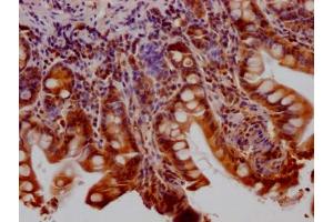 IHC image of ABIN7127558 diluted at 1:100 and staining in paraffin-embedded human small intestine tissue performed on a Leica BondTM system. (Recombinant Huntingtin anticorps)