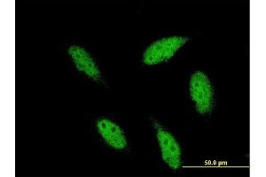 Immunofluorescence of monoclonal antibody to TBR1 on HeLa cell. (TBR1 anticorps  (AA 1-108))